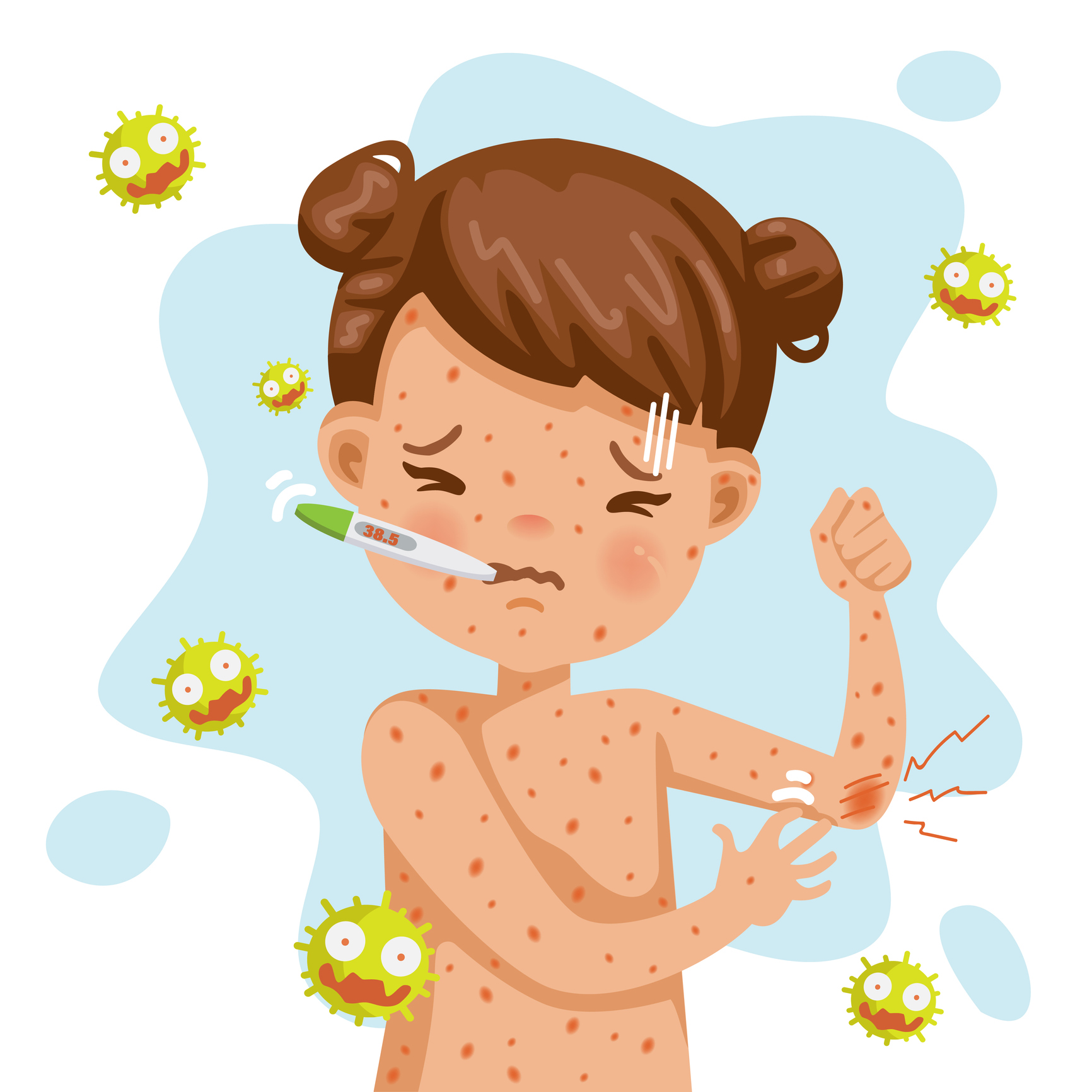 graphic of measles rash